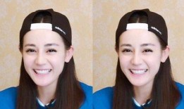 牙医爆料明星整牙视频